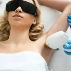 Mujer con gafas protectoras recibe tratamiento de depilación láser SHR en axilas.