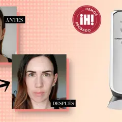 Comparativa antes y después de un tratamiento de radiofrecuencia facial. Dispositivo RF CurrentBody Skin.