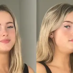 Chica rubia sonriendo en la izquierda, y en la derecha muestra cómo se ve su mandíbula con la técnica de "mewing" para definir el rostro.