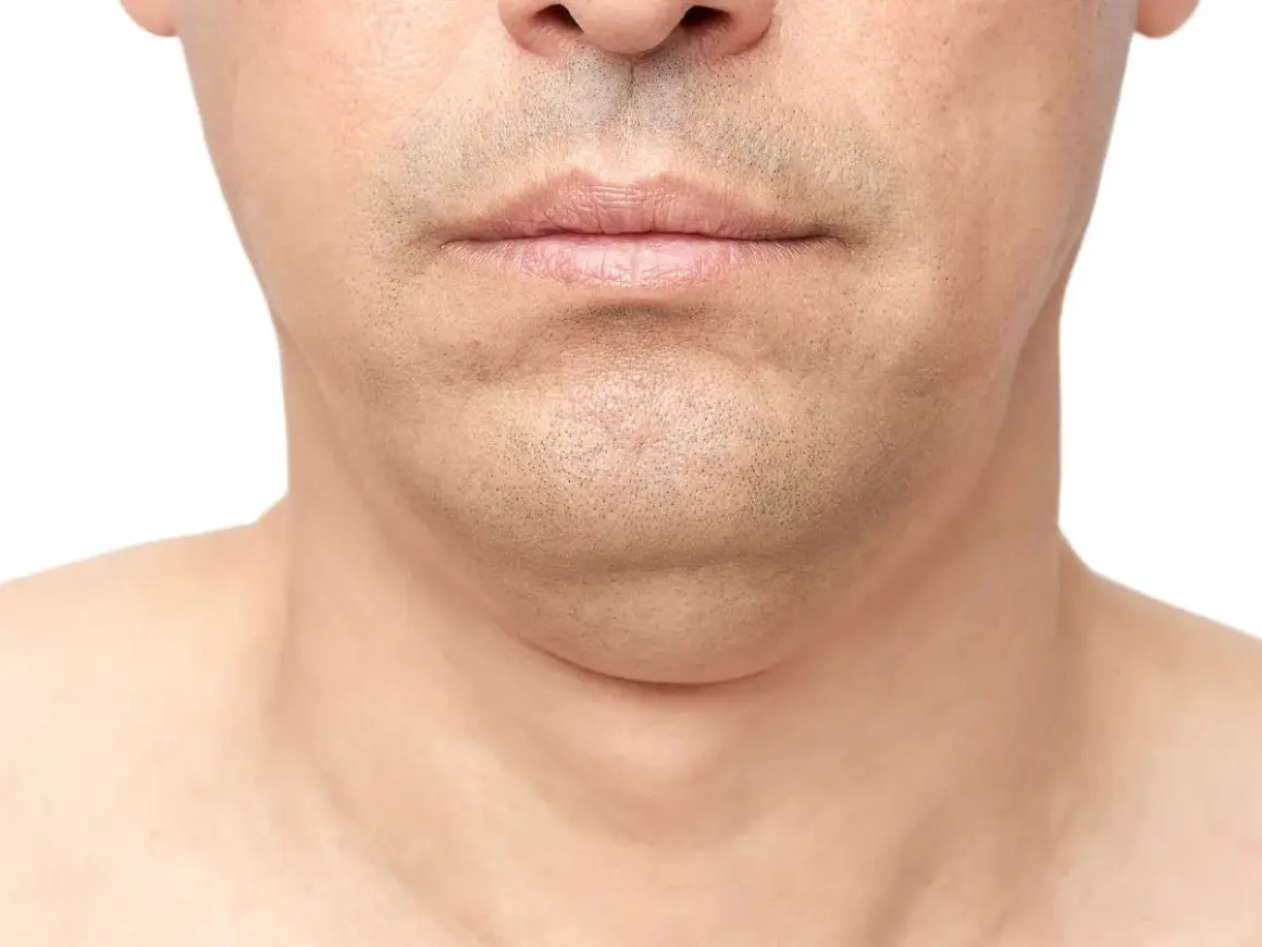 Primer plano de la barbilla y el cuello de un hombre, mostrando papada. Una imagen que ilustra cómo adelgazar la cara.