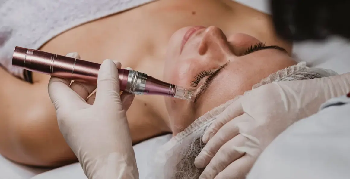 Manos enguantadas realizan microneedling capilar en la frente de una mujer. El dispositivo de microneedling tiene un cabezal con agujas finas.