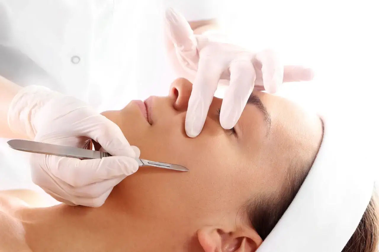 Manos enguantadas realizan un dermaplaning facial con un bisturí para exfoliar la piel y eliminar el vello fino.
