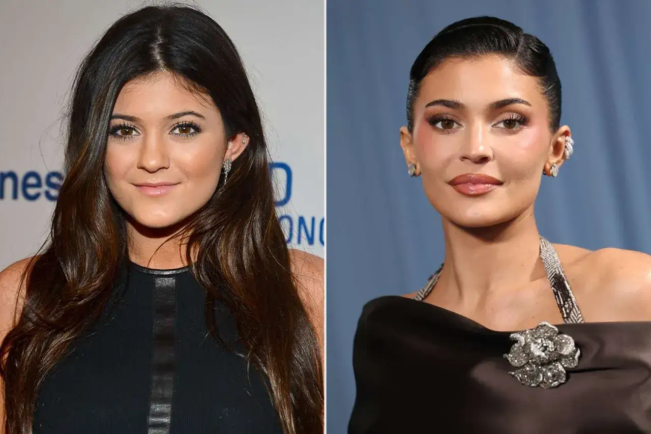 Comparación de Kylie Jenner antes y después, mostrando su evolución en estilo y apariencia.